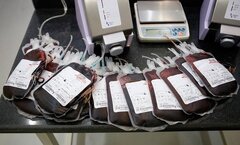 تولید دستگاه اشعه خون پیشرفته با همکاری سازمان انرژی اتمی