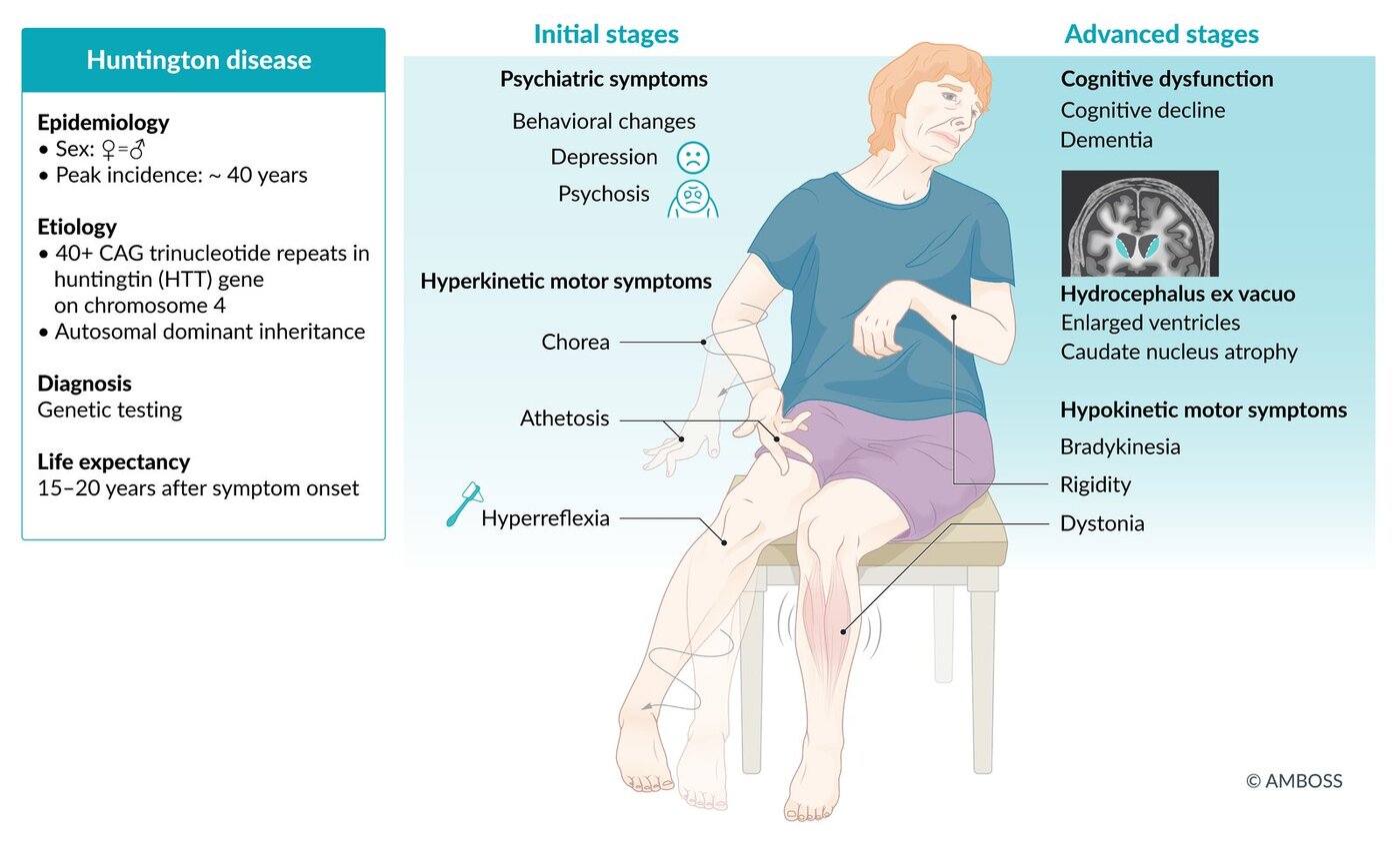 درمان ژنی؛ امید تازه برای بیماران هانتینگتون