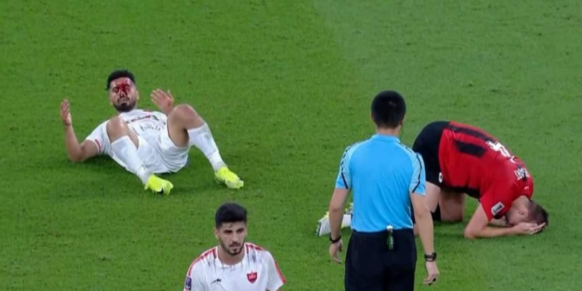 امید عالیشاه دچار عارضه مغزی نشده است